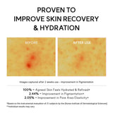 PDRN Booster Shot, Rosy-PDRN & Peptides for Glowy, Healthy Skin - Recommended for Sensitive, Red Skin 1.01 fl oz