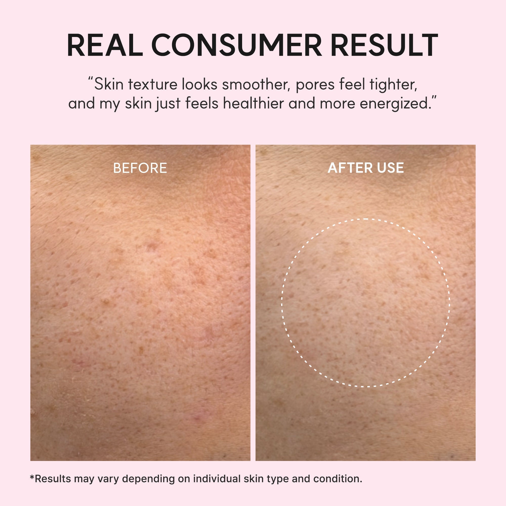 PDRN Booster Shot, Rosy-PDRN & Peptides for Glowy, Healthy Skin - Recommended for Sensitive, Red Skin 1.01 fl oz