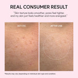 PDRN Booster Shot, Rosy-PDRN & Peptides for Glowy, Healthy Skin - Recommended for Sensitive, Red Skin 1.01 fl oz