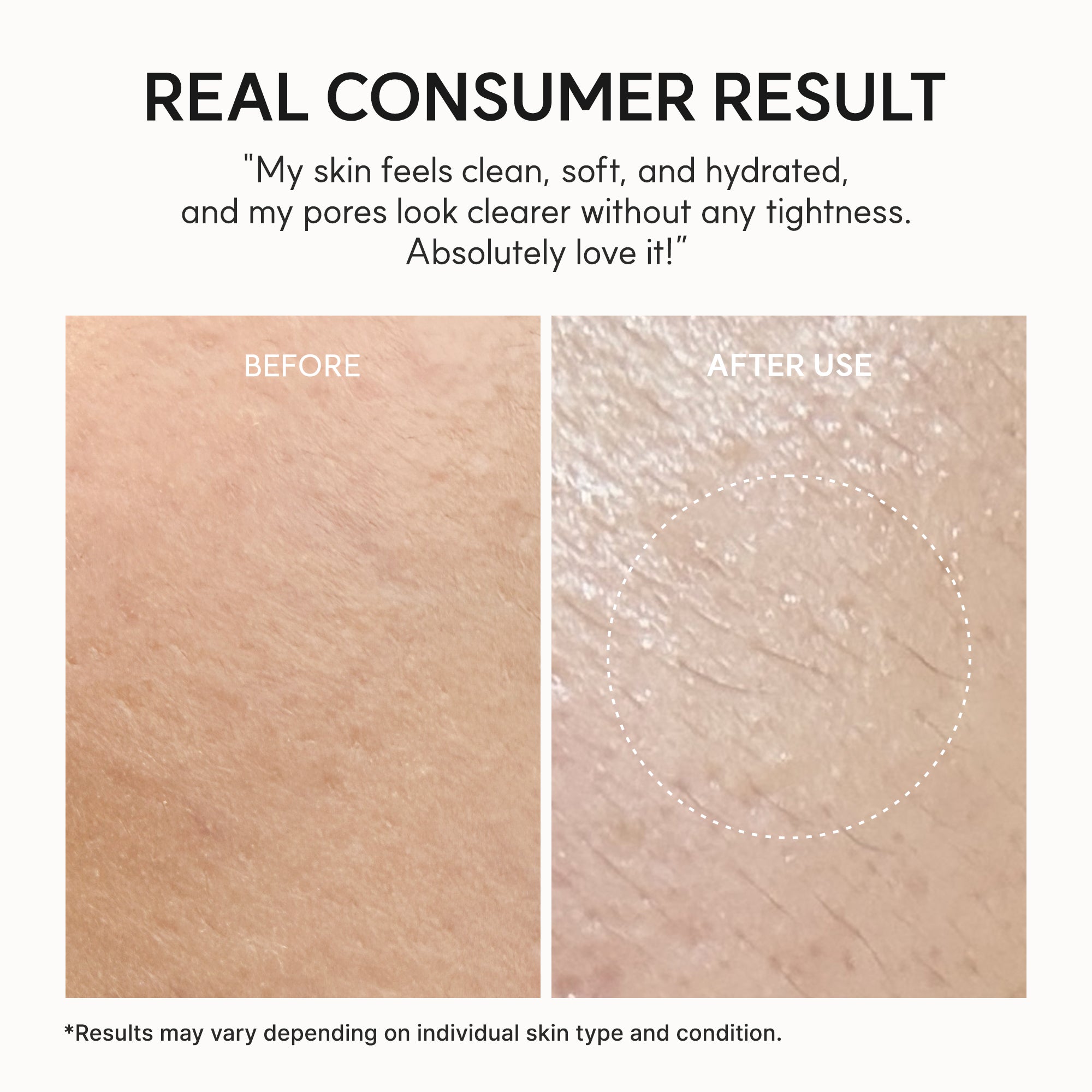 Arencia Fresh Rosehip Rice Mochi Cleanser | Buy 1 Get 1 Free