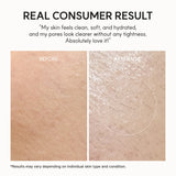 Arencia Fresh Rosehip Rice Mochi Cleanser | Buy 1 Get 1 Free