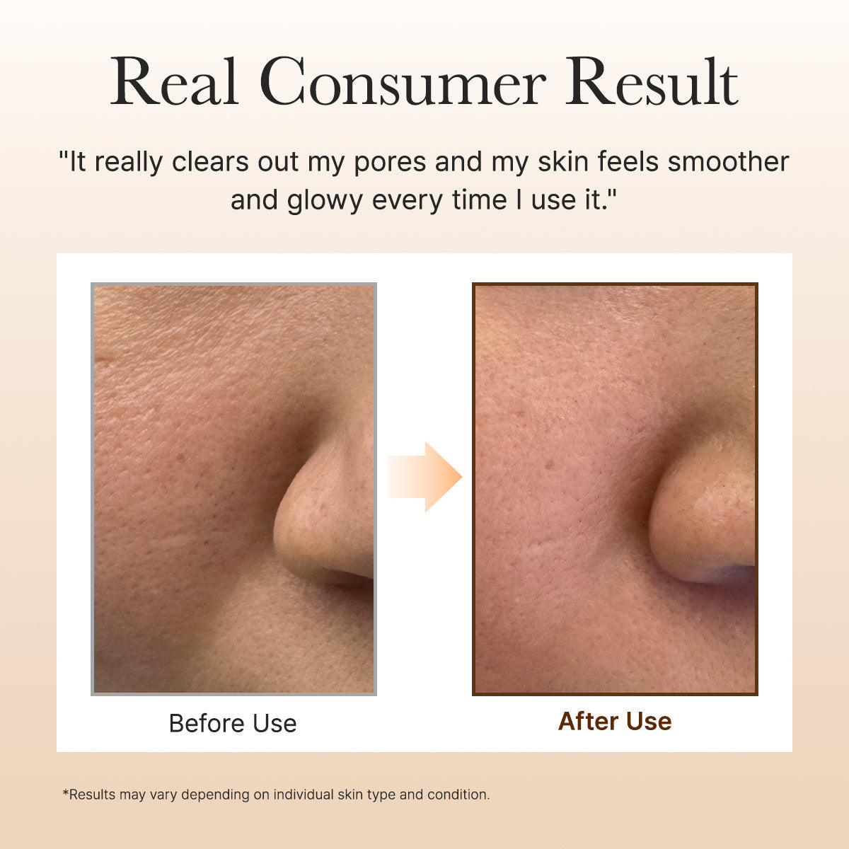 Calendula Rice Mochi Cleanser, Gentle Exfoliating Foam Wash for Sensitive, Dry, Rough Skin