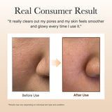 Calendula Rice Mochi Cleanser, Gentle Exfoliating Foam Wash for Sensitive, Dry, Rough Skin